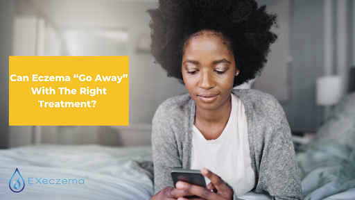 Can Eczema “Go Away” With The Right Treatment?
