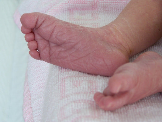 Explaining Eczema With Dr Harley