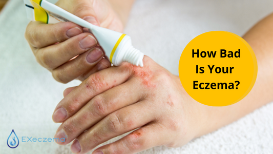 EXeczema eczema score