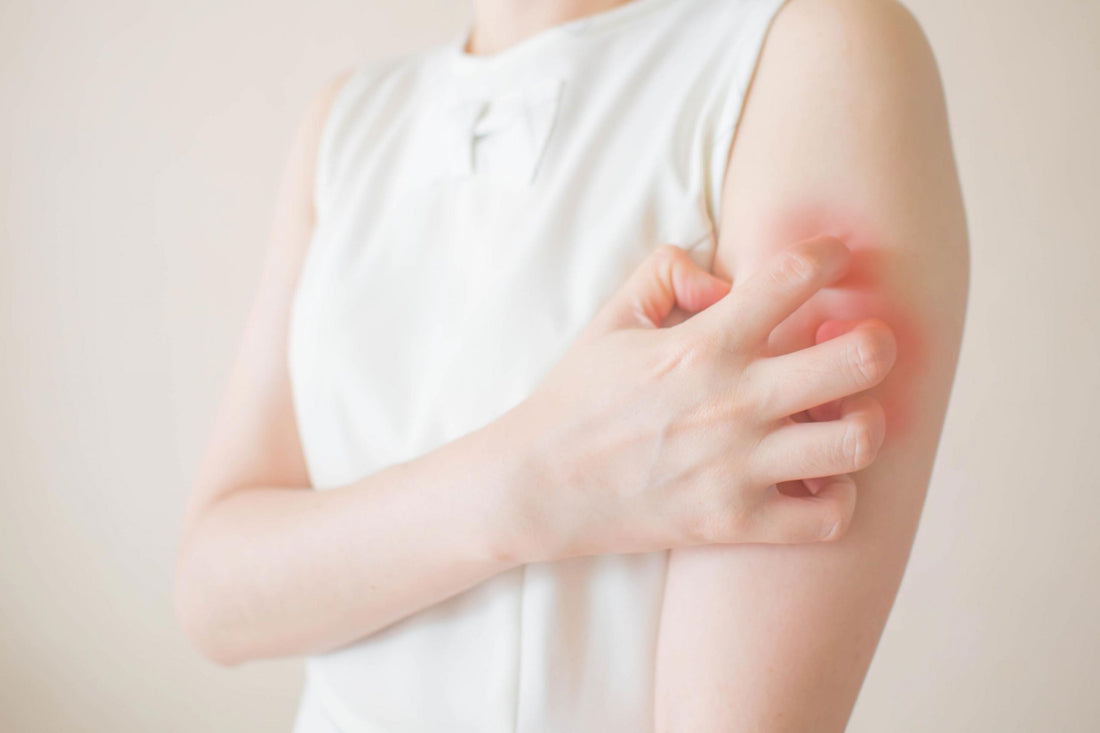 The common areas affected by Eczema