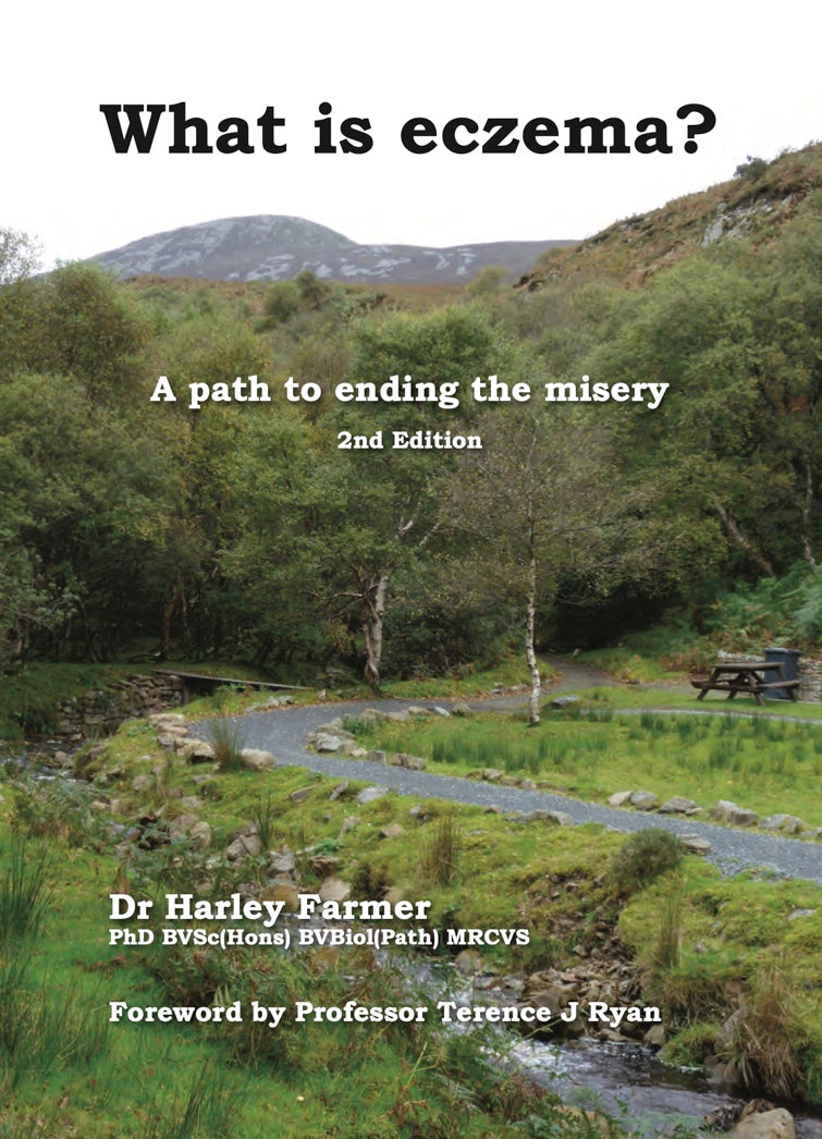 Execzema What is eczema? A path to ending the misery. 2nd edition. – EXeczema UK