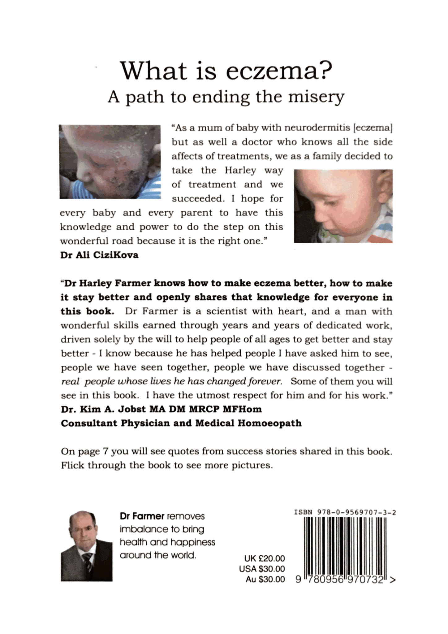 Execzema What is eczema? A path to ending the misery. 2nd edition. – EXeczema UK