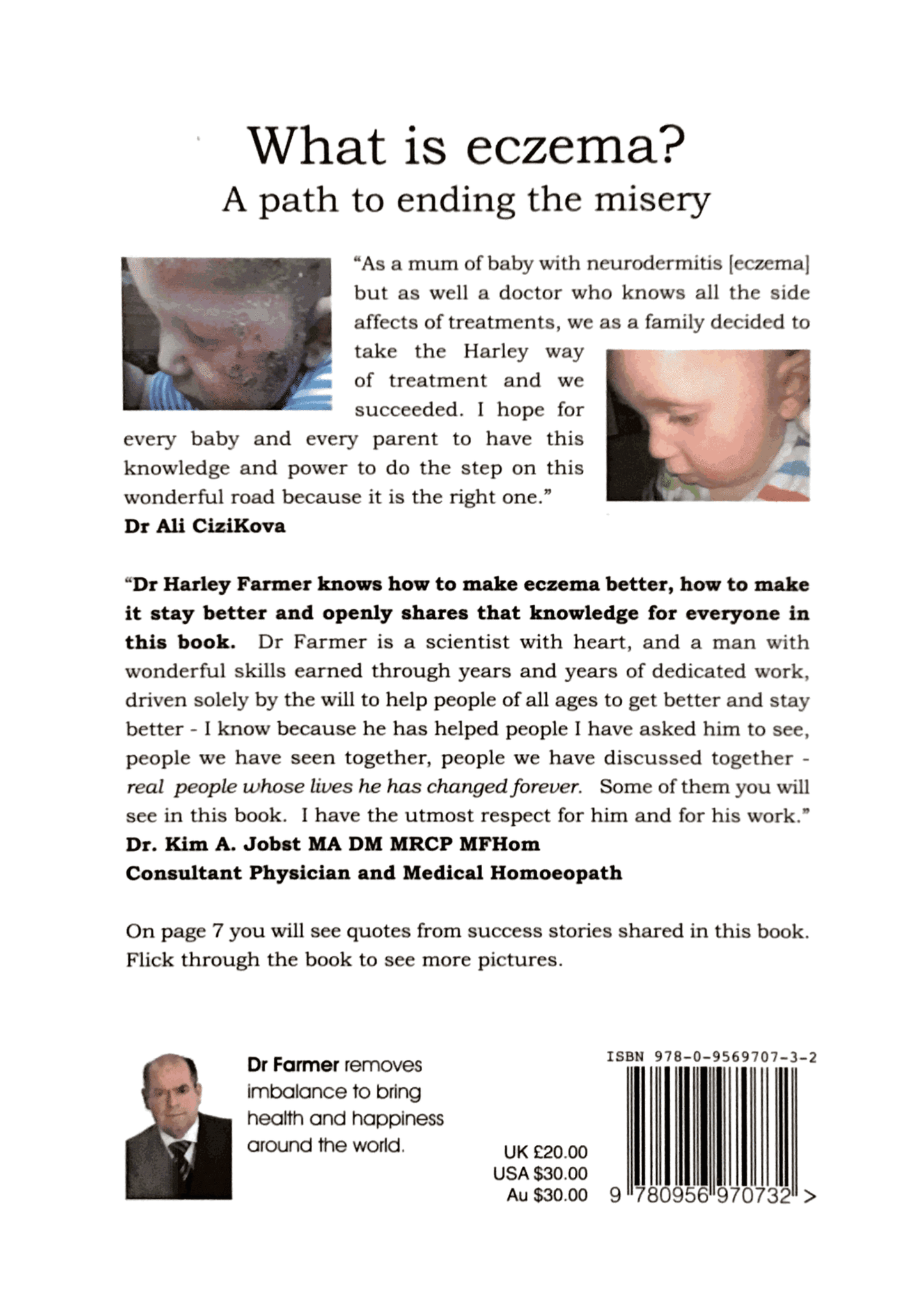 What is eczema? A path to ending the misery. 2nd edition.